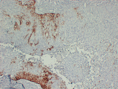 Cytokeratin 15 (2B7) Mouse Monoclonal Antibody