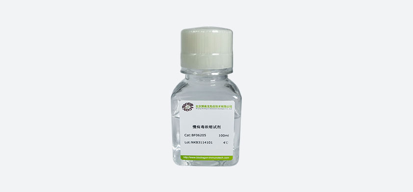 慢病毒浓缩试剂